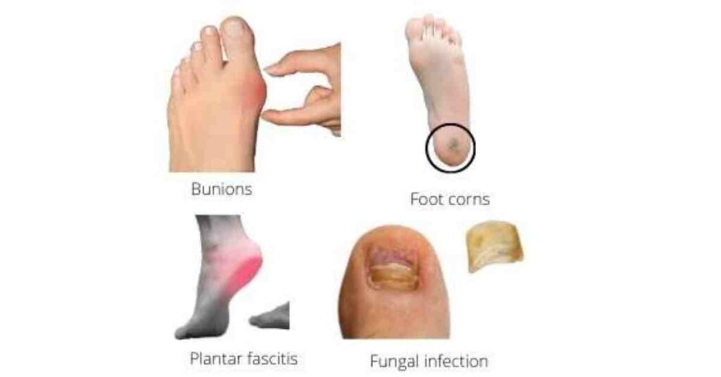Foot problems and their remedies